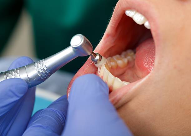 Trusted Many, LA Dental Services Experts